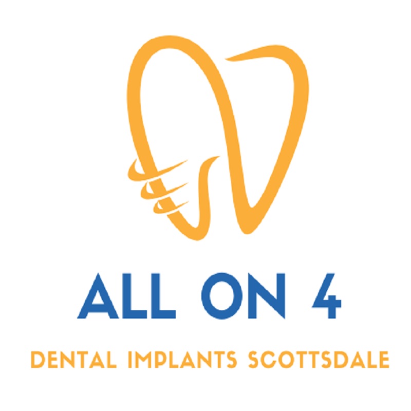 All-on-4 Dental Implants Scottsdale