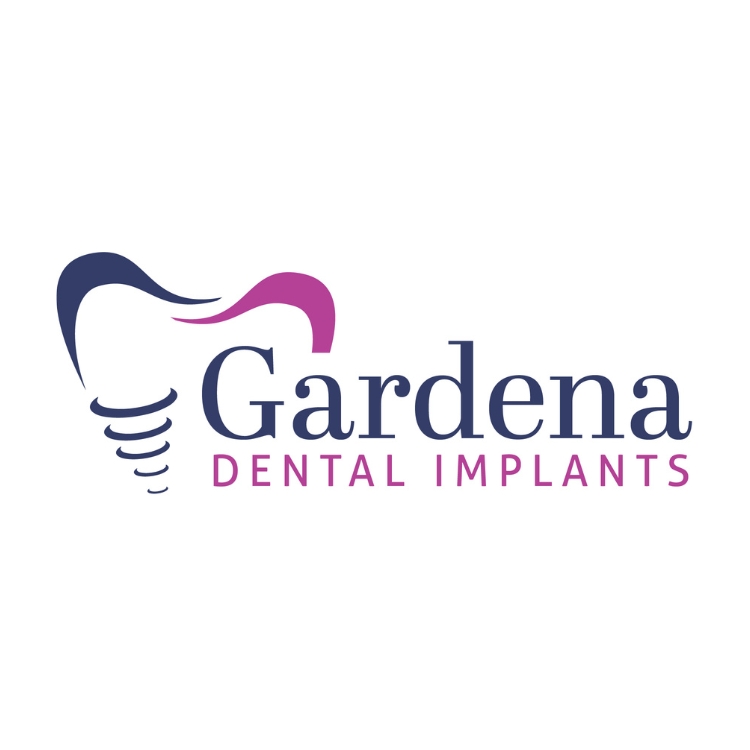 Gardena Dental Implants